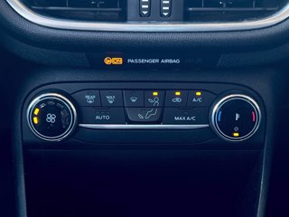 FORD Fiesta 5p 1.1 Titanium 75cv